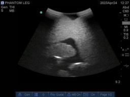 Ultrasound Scans