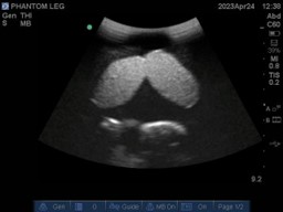 Ultrasound Scans