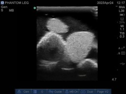 Ultrasound Scans