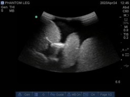 Ultrasound Scans