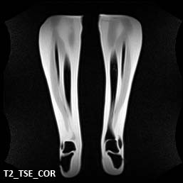 MRI Scans