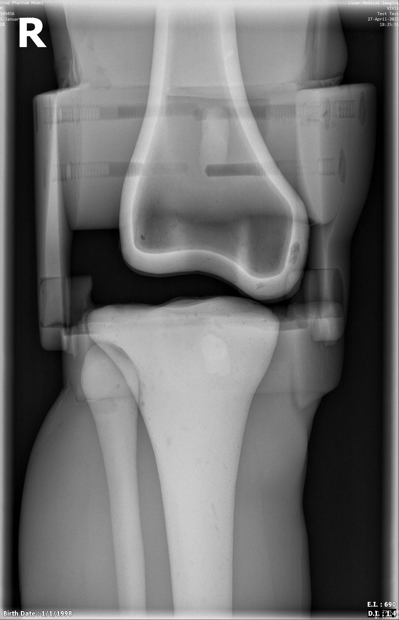X-Ray Scans