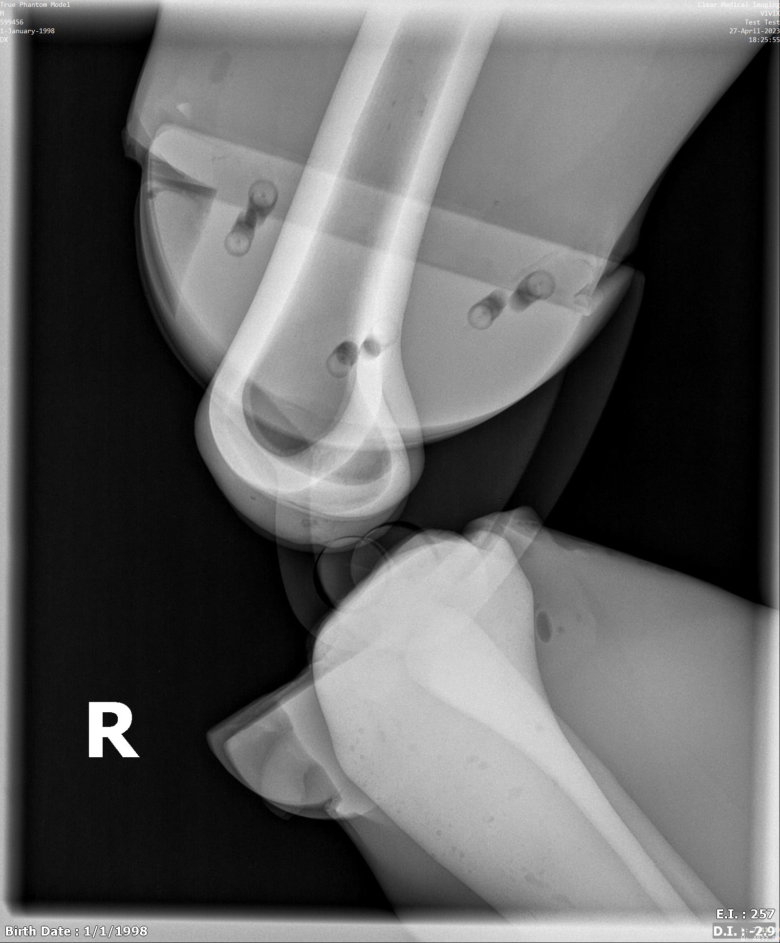 X-Ray Scans
