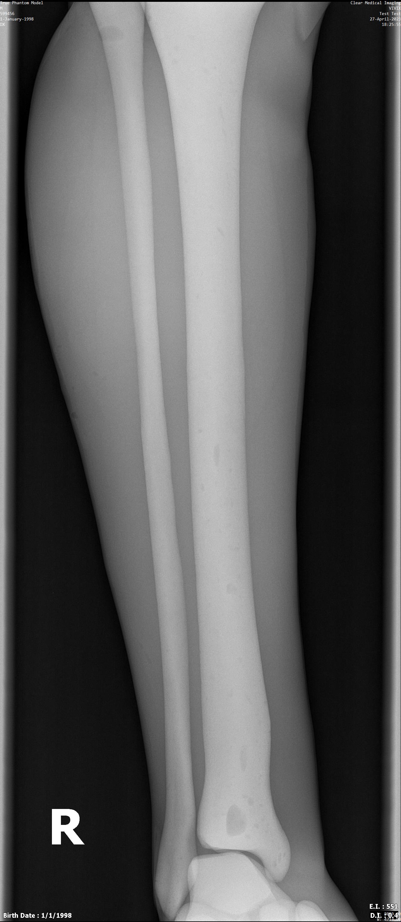X-Ray Scans