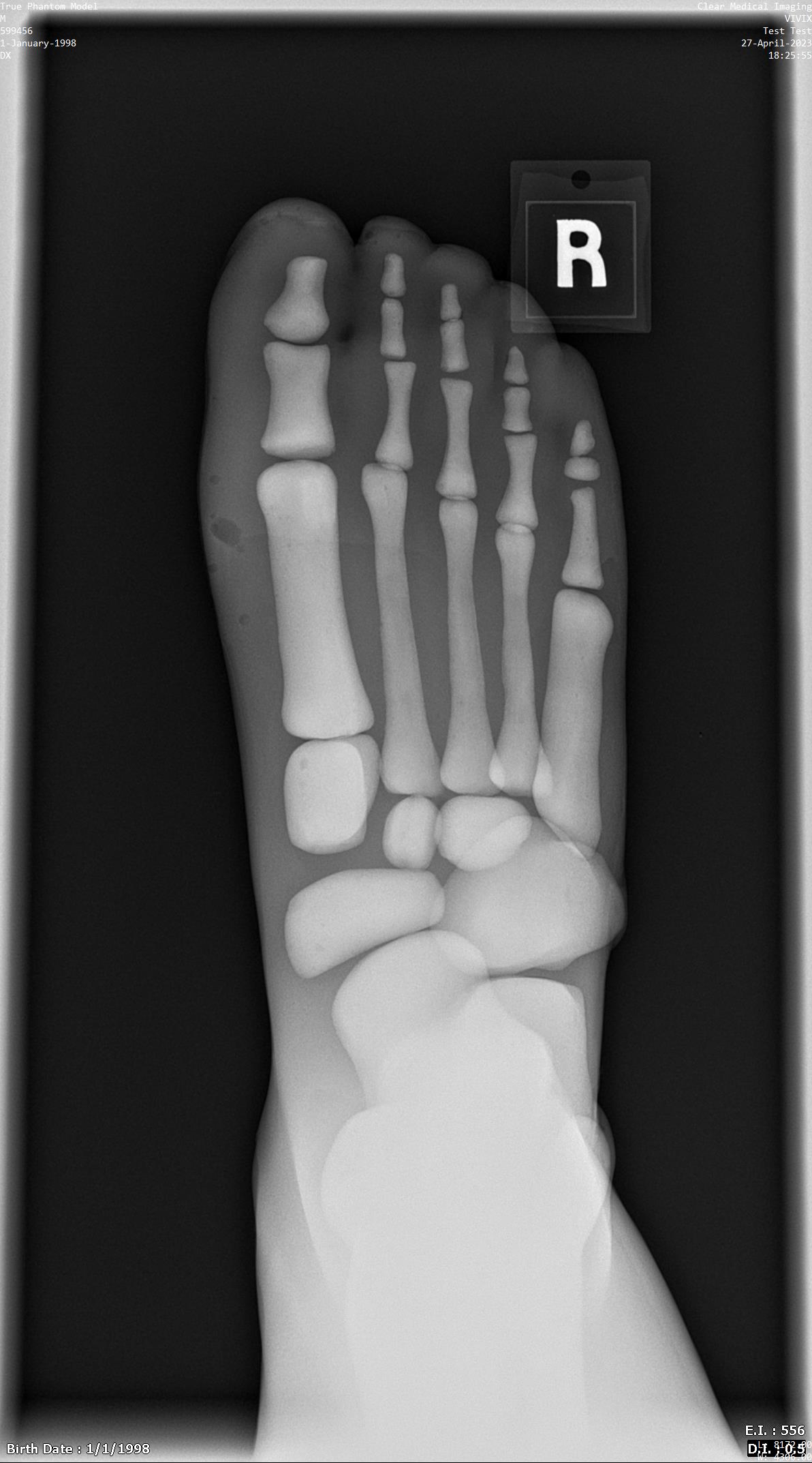 X-Ray Scans