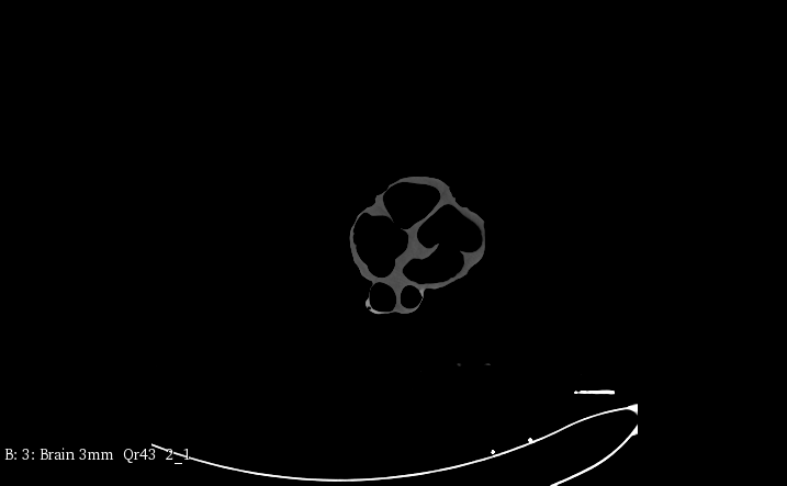 CT Scans