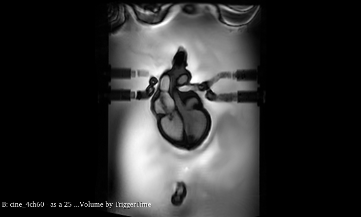 MRI Scans