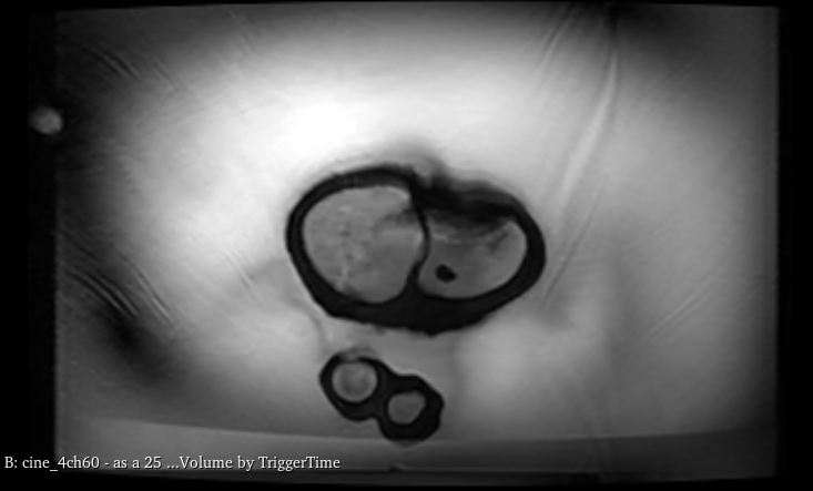 MRI Scans
