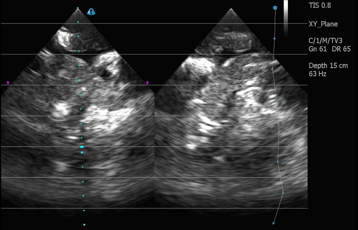 Ultrasound Scans