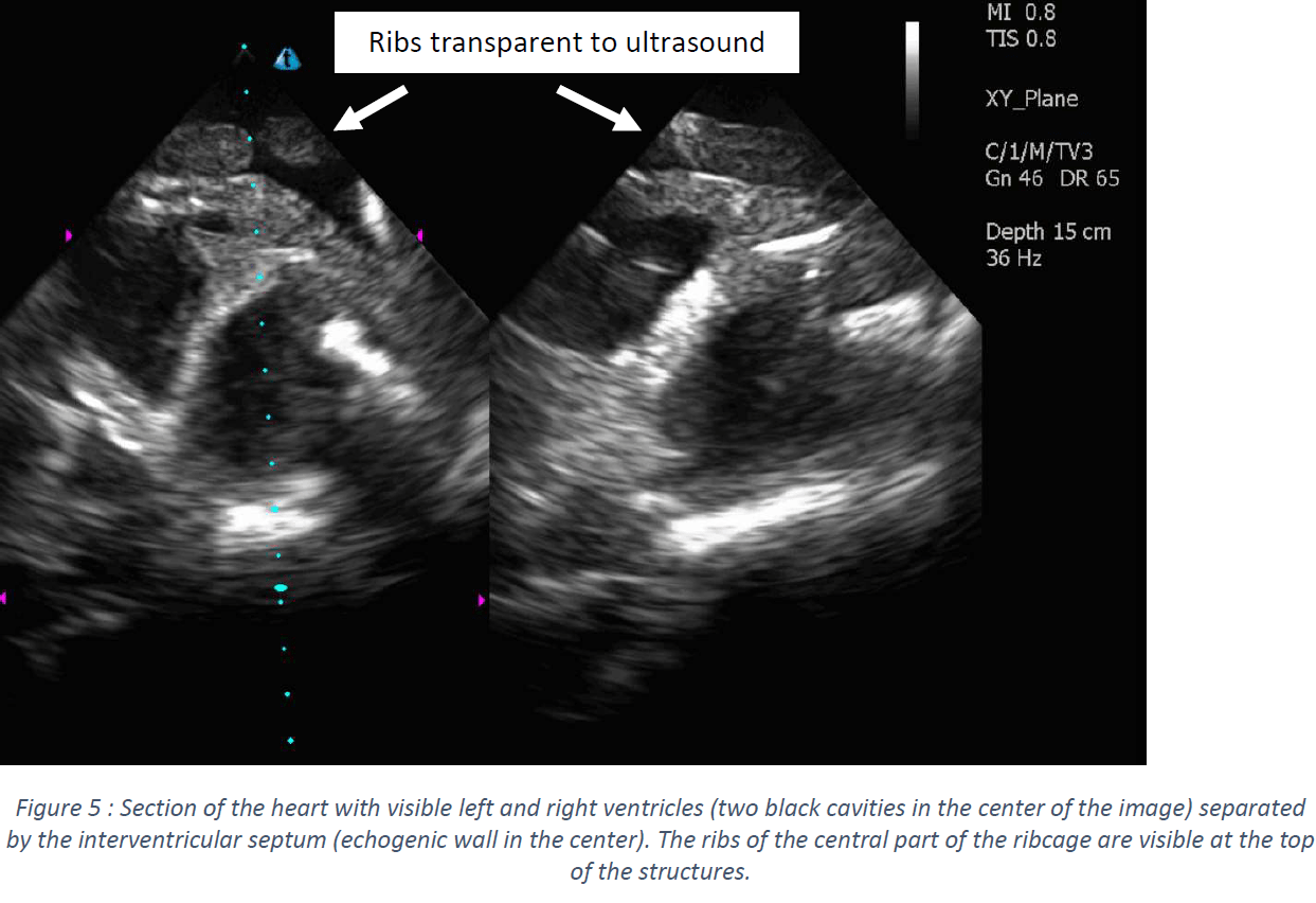Ultrasound Scans