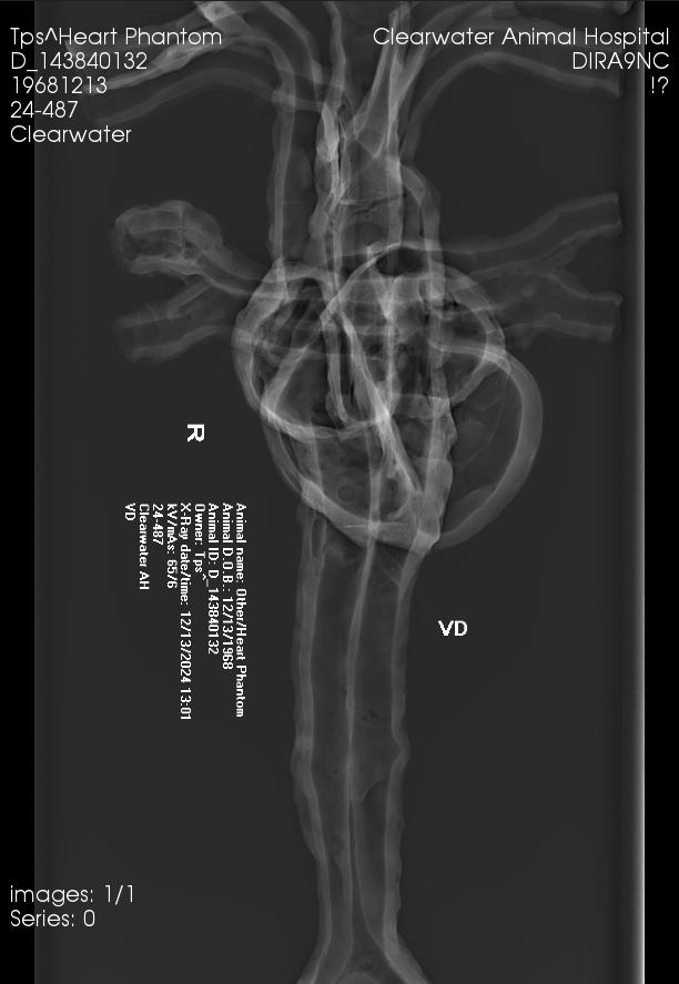 X-Ray Scans