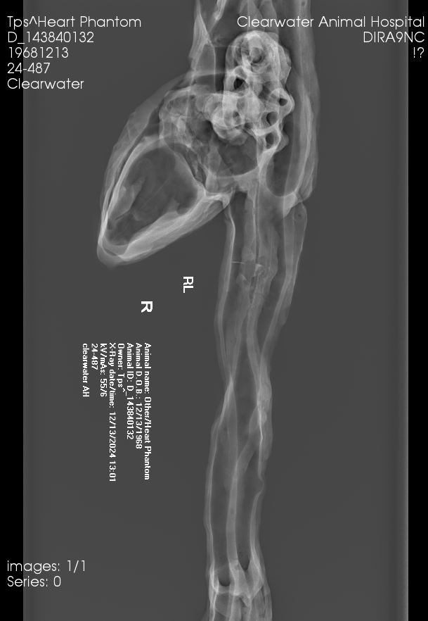 X-Ray Scans