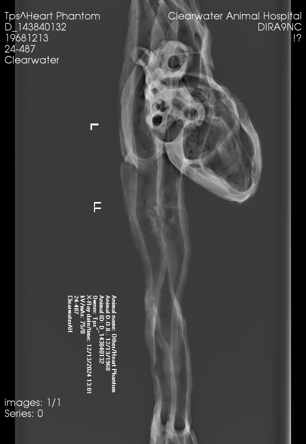 X-Ray Scans