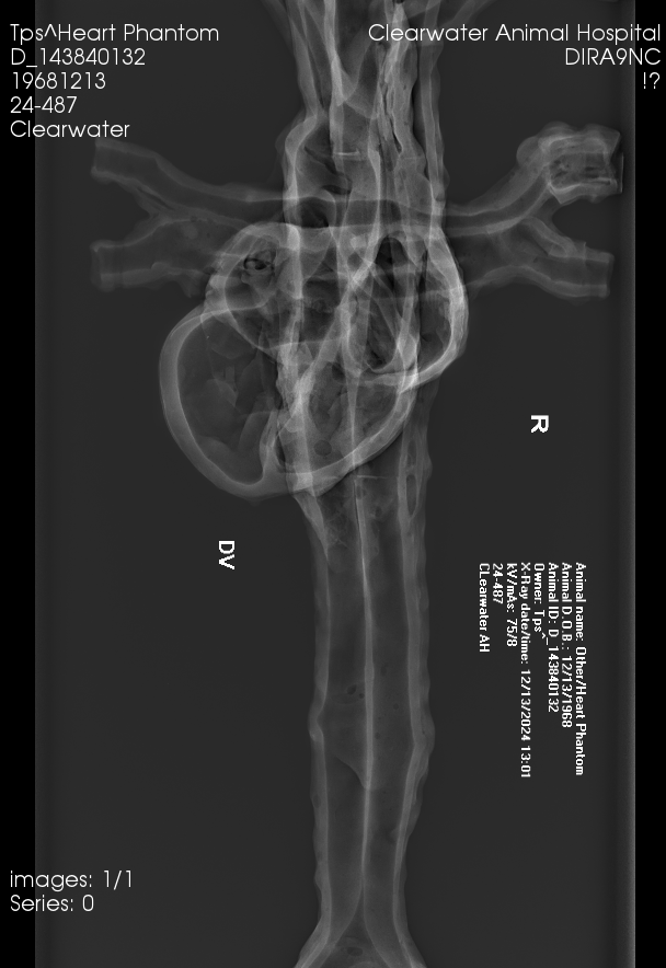X-Ray Scans