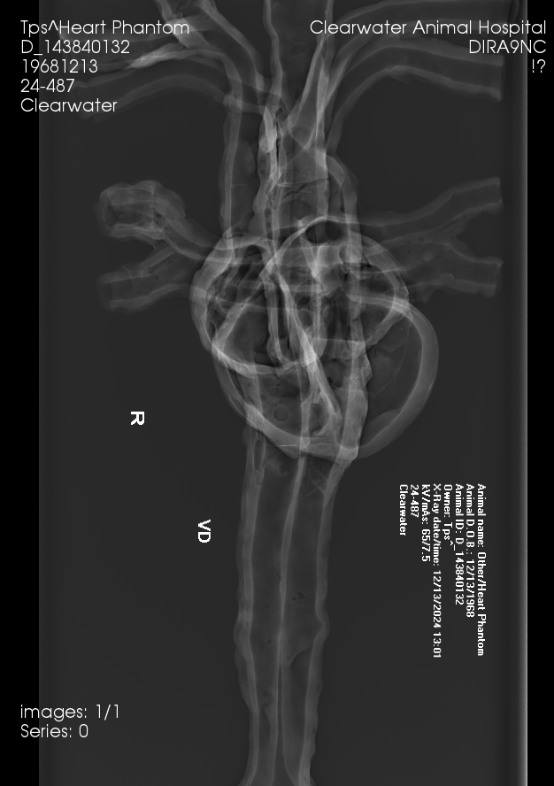 X-Ray Scans