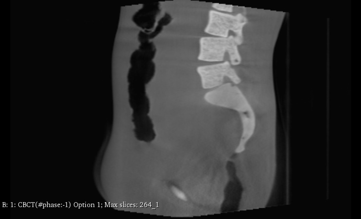 CT Scans