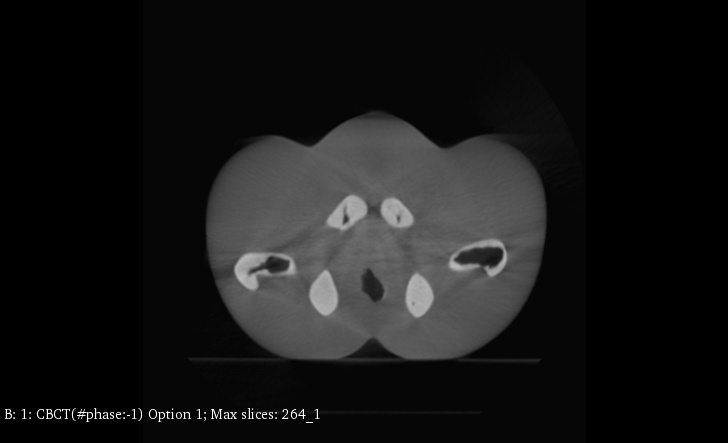 CT Scans
