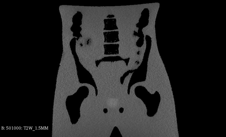 MRI Scans
