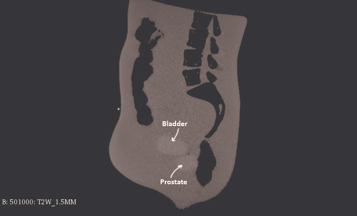 MRI Scans