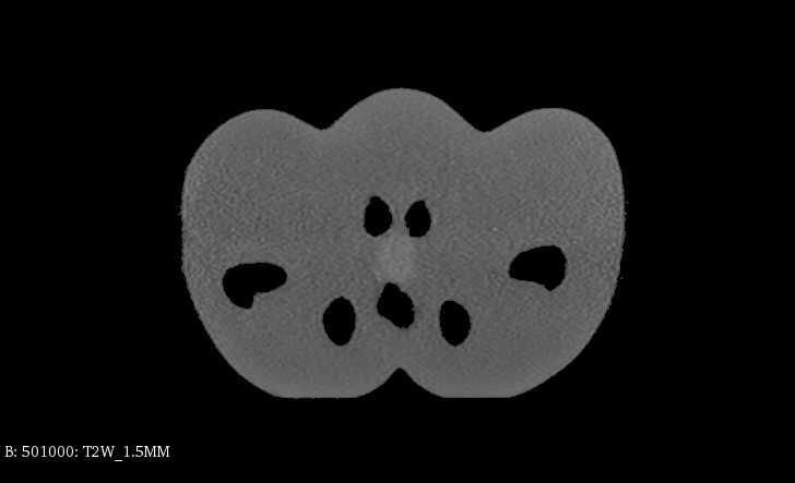 MRI Scans