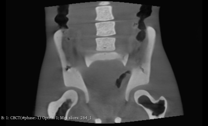 CT Scans