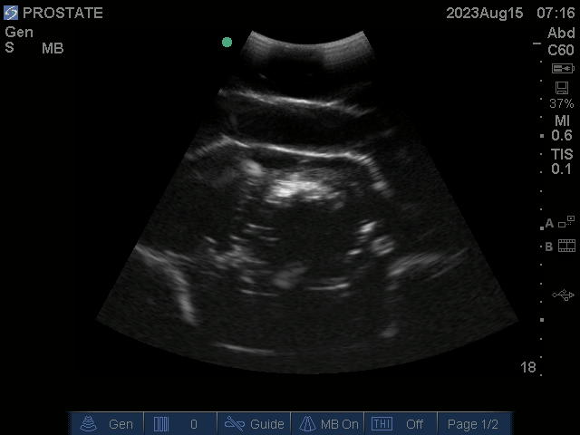 Ultrasound Scans