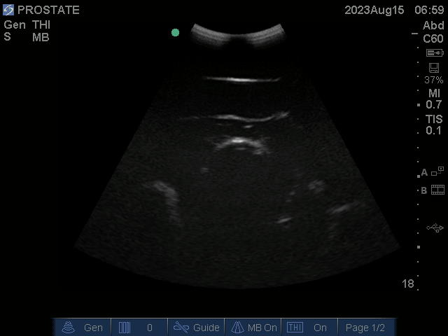 Ultrasound Scans