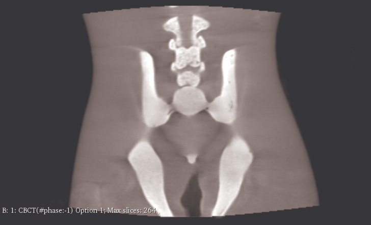 CT Scans