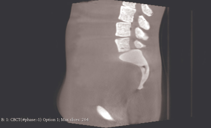 CT Scans