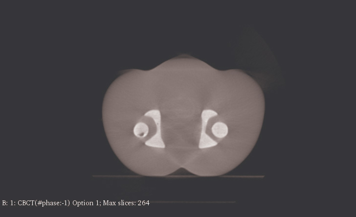 CT Scans