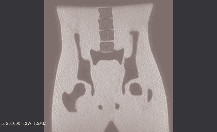 MRI Scans