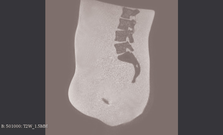 MRI Scans