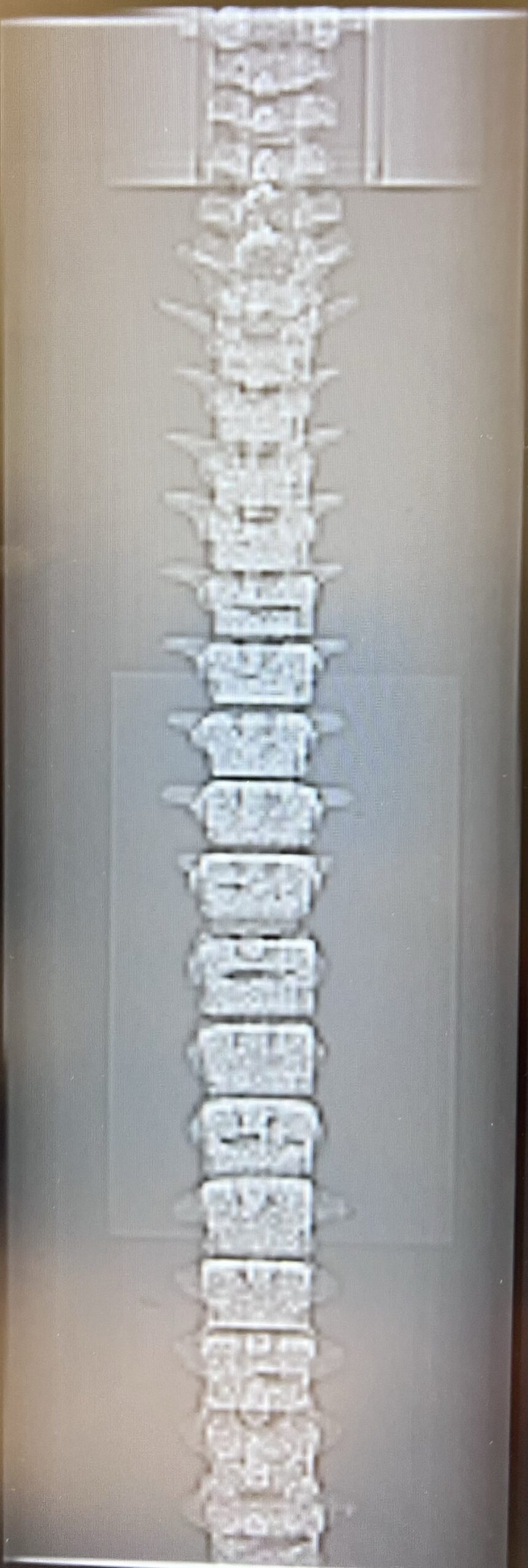 X-Ray Scans