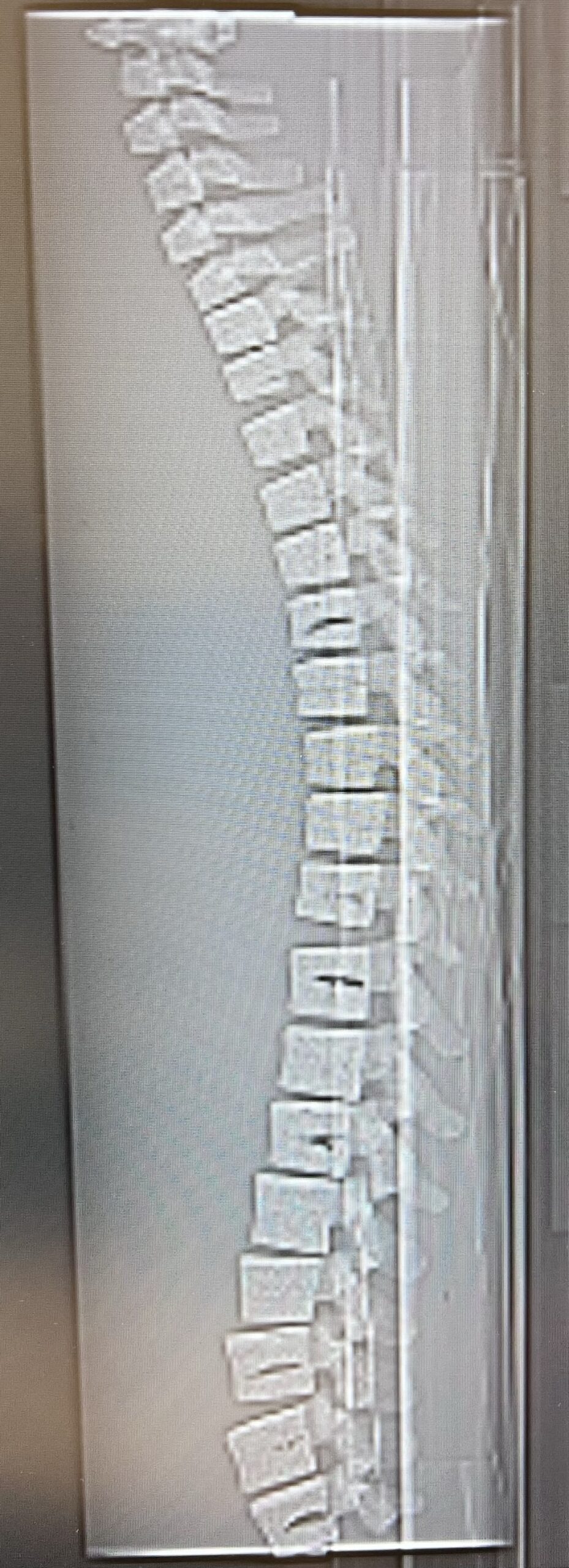X-Ray Scans