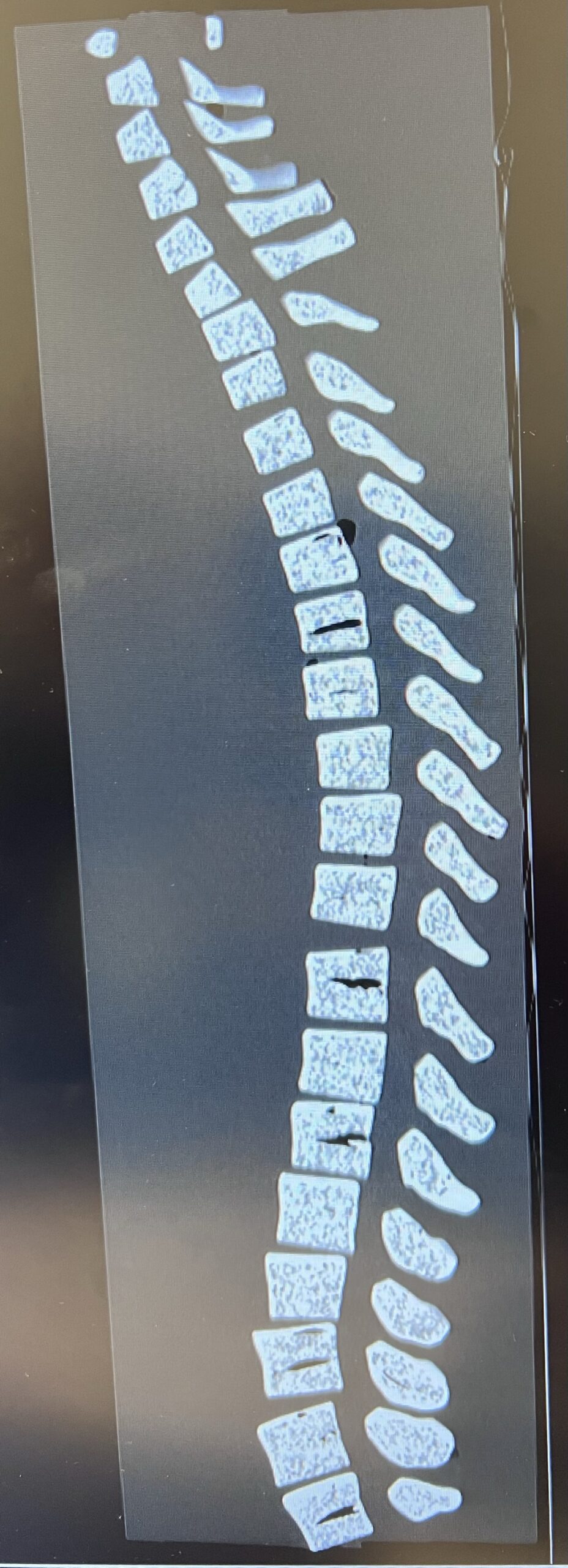 X-Ray Scans
