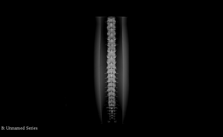 X-Ray Scans