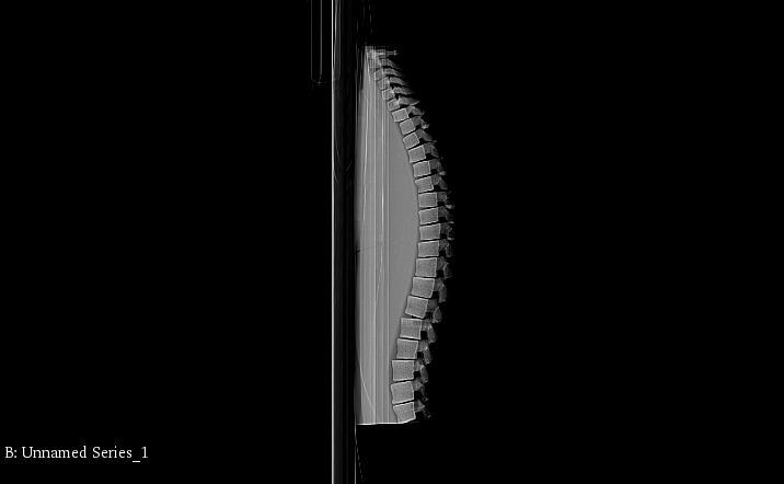 X-Ray Scans