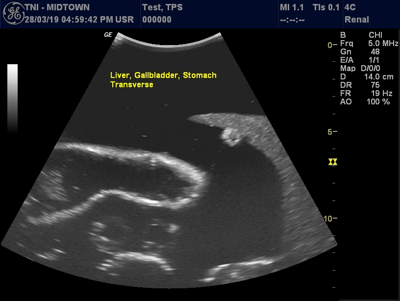 Ultrasound Scans