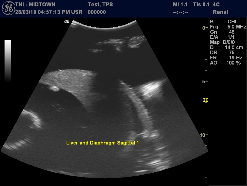 Ultrasound Scans