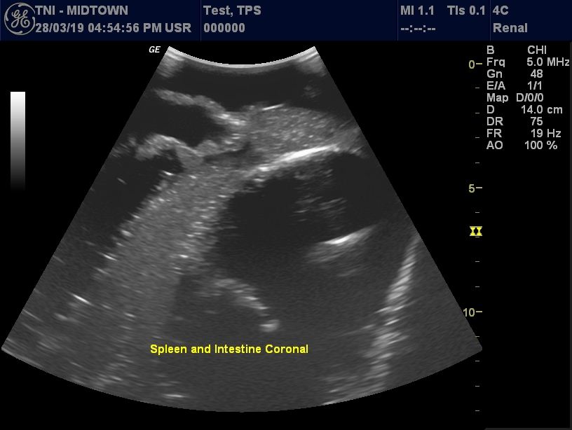 Ultrasound Scans