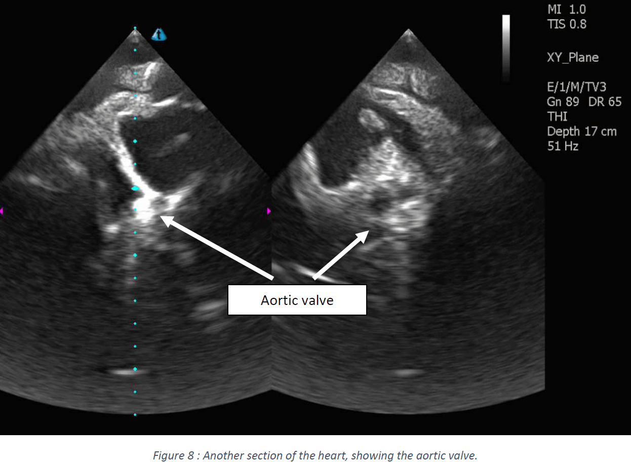 Ultrasound Scans