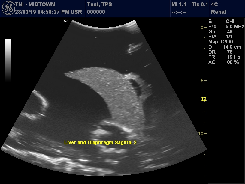Ultrasound Scans