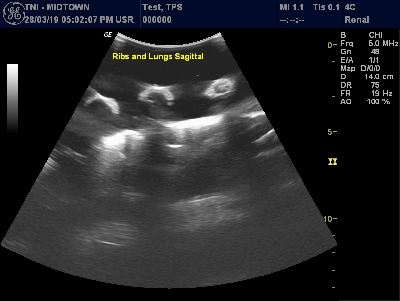 Ultrasound Scans