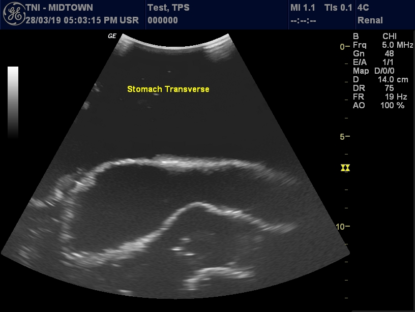 Ultrasound Scans