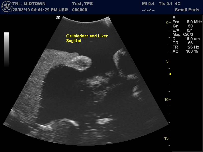 Ultrasound Scans