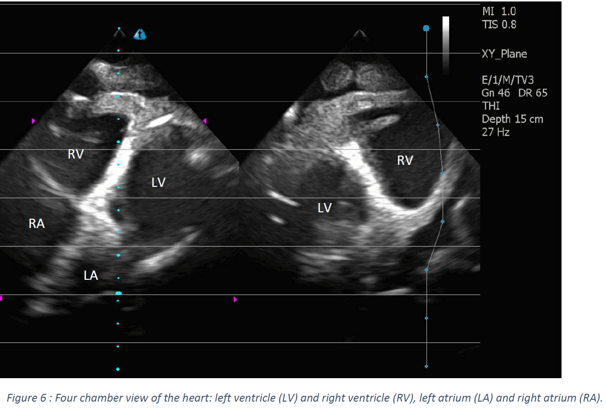 Ultrasound Scans