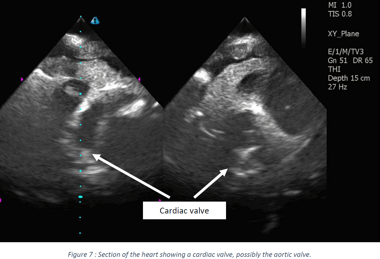 Ultrasound Scans
