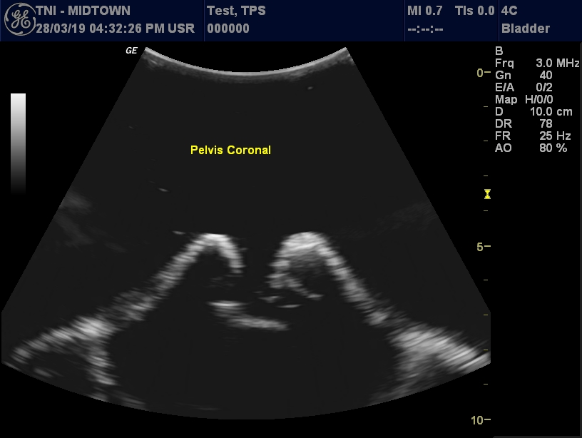 Ultrasound Scans