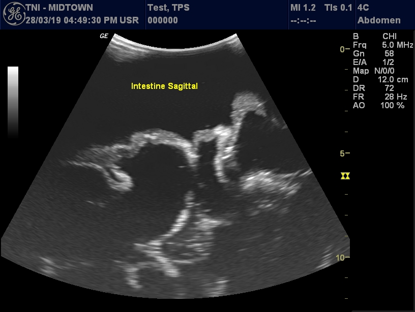 Ultrasound Scans