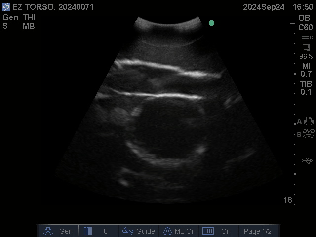 Ultrasound Scans